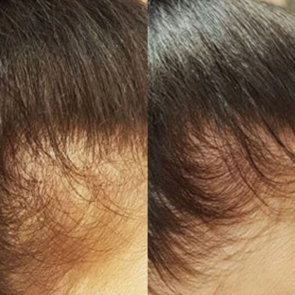 Lizzante carrossel 2