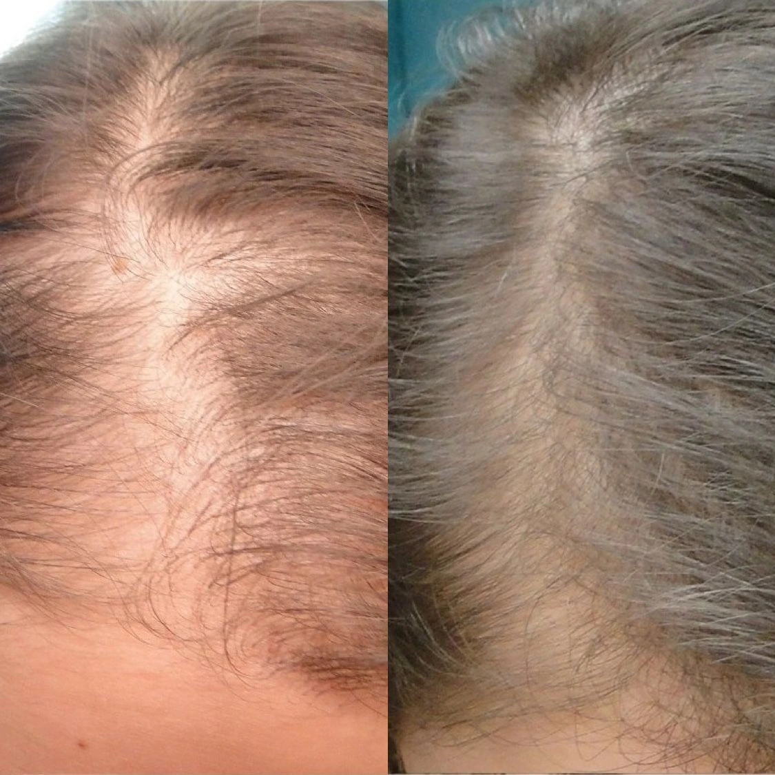 Lizzante carrossel 6